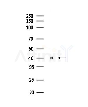 ACADVL Antibody - Western blot analysis of lysates from Rat liver, using ACADVL Antibody at 1/1000 dilution.