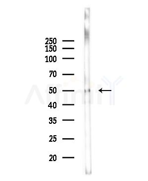 ACADVL Antibody - Western blot analysis of lysates from Mouse lung, using ACADVL Antibody at 1/1000 dilution.