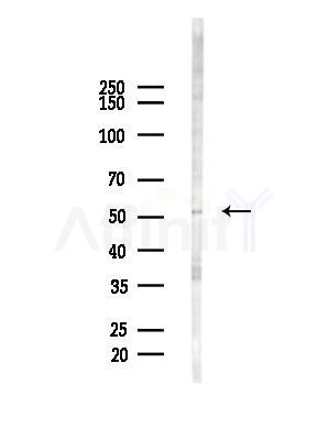AEBP2 Antibody - Western blot analysis of lysates from EC304 cells(heat-shock,45min treatment), using AEBP2 Antibody at 1/1000 dilution.