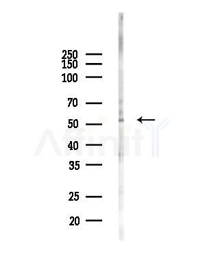 AEBP2 Antibody - Western blot analysis of lysates from HUVEC cells(LPC4h treatment), using AEBP2 Antibody at 1/1000 dilution.