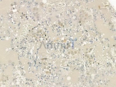 ASAH1 Antibody - DF12248 at 1/100 staining human normal lung tissue by IHC-P.