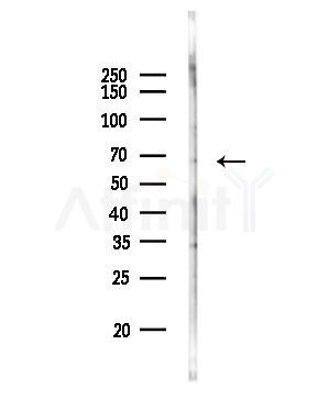 BBS7 Antibody - Western blot analysis of lysates from Rat brain, using BBS7 Antibody at 1/1000 dilution.