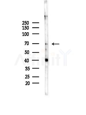 CCDC22 Antibody - Western blot analysis of lysates from COLO205 cells(heat-shock,45min treatment), using CCDC22 Antibody at 1/1000 dilution.