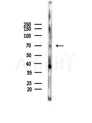 CCDC22 Antibody - Western blot analysis of lysates from A375 cells(starvation,24h treatment), using CCDC22 Antibody at 1/1000 dilution.