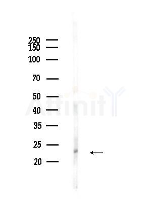 Centrin 2 Antibody - Western blot analysis of lysates from HepG2 cells(heat-shock,45min treatment), using Centrin 2 Antibody at 1/1000 dilution.