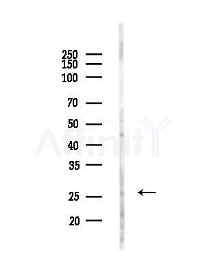CHCHD6 Antibody - Western blot analysis of lysates from HUVEC cells(LPC4h treatment), using CHCHD6 Antibody at 1/1000 dilution.
