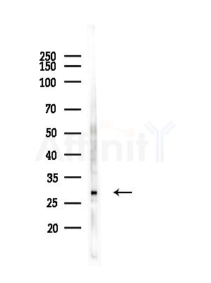 CHMP4B Antibody - Western blot analysis of lysates from A375 cells(heat-shock, 45min treatment), using CHMP4B Antibody at 1/1000 dilution.