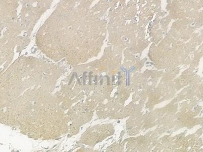 CHMP4B Antibody - DF12256 at 1/100 staining human normal gastric tissue by IHC-P.