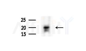 COQ7 Antibody - Western blot analysis of extracts from COLO205 cells(heat-shock treatment), using COQ7 Antibody at 1/1000 dilution.
