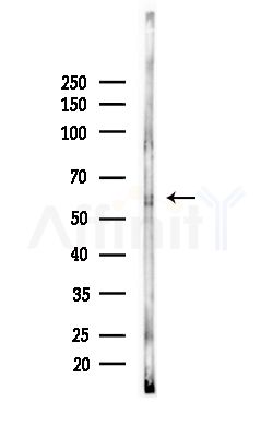 CREST Antibody - Western blot analysis of lysates from Mouse brain, using CREST Antibody at 1/1000 dilution.