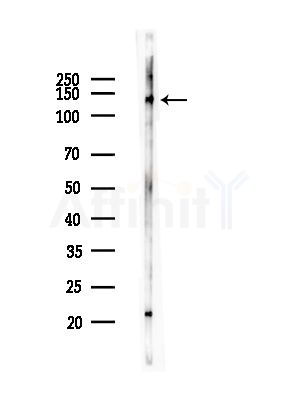 DHX9 Antibody - Western blot analysis of lysates from B16F10-LUC cells(heat-shock, 45min treatment), using DHX9 Antibody at 1/1000 dilution.