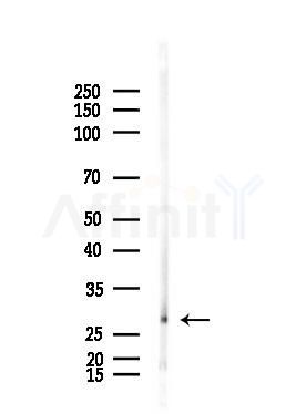 DNAJB3 Antibody - Western blot analysis of lysates from Raji cells(heat-shock,45min treatment), using DNAJB3 Antibody at 1/1000 dilution.