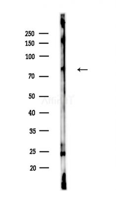 DNAJC10 Antibody - Western blot analysis of lysates from A375 cells(LPS,4h treatment), using DNAJC10 Antibody at 1/1000 dilution.