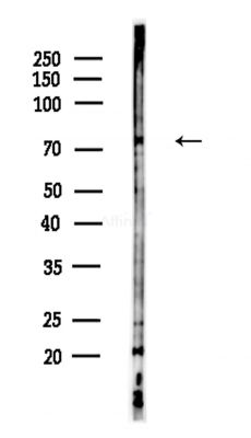 DNAJC10 Antibody - Western blot analysis of lysates from Hela cells(heat-shock,45min treatment), using DNAJC10 Antibody at 1/1000 dilution.