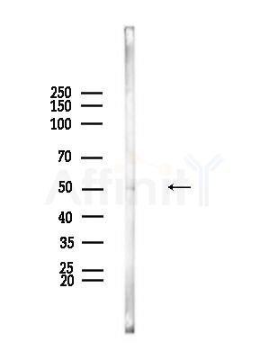 DYX1C1 Antibody - Western blot analysis of lysates from Rat brain, using DYX1C1 Antibody at 1/1000 dilution.