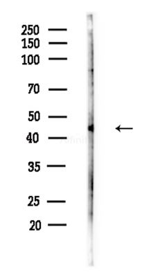 GSDMD Antibody - Western blot analysis of lysates from Hela cells(heat-shock,45min treatment), using GSDMD Antibody at 1/1000 dilution.