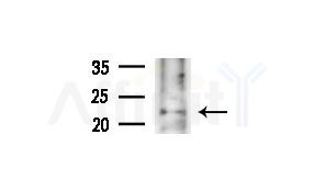 HBXIP Antibody - Western blot analysis of extracts from COLO205 cells(heat-shock treatment), using HBXIP Antibody at 1/1000 dilution.