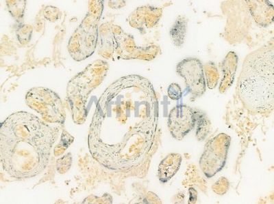 Hemoglobin epsilon Antibody - DF12277 at 1/100 staining human normal placenta tissue by IHC-P.