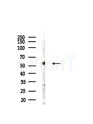 HERP Antibody - Western blot analysis of lysates from Hela cells(starvation,24h treatment), using HERP Antibody at 1/1000 dilution.