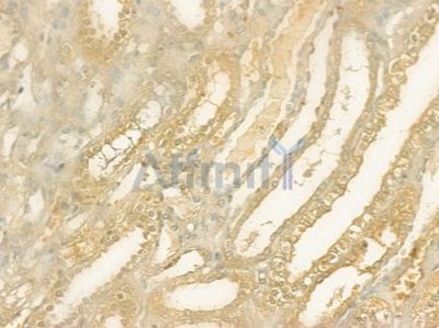 HOMER1 Antibody - DF12280 at 1/100 staining human normal kidney tissue by IHC-P.