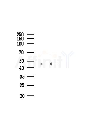 IVD Antibody - Western blot analysis of lysates from A375 cells(heat-shock,45min treatment), using IVD Antibody at 1/1000 dilution.