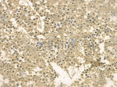 KIF12 Antibody - DF12285 at 1/100 staining human pituitary adenoma by IHC-P.