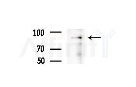 KIF18A Antibody - Western blot analysis of extracts from COLO205 cells(heat-shock treatment), using KIF18A Antibody at 1/1000 dilution.