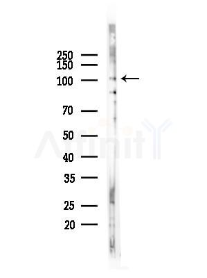 KIF18A Antibody - Western blot analysis of lysates from COLO205 cells(heat-shock,45min treatment), using KIF18A Antibody at 1/1000 dilution.