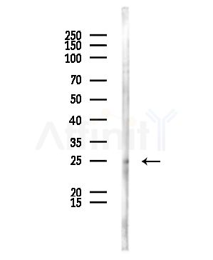 MAD2L2 Antibody - Western blot analysis of lysates from HepG2 cells(starvation,24h treatment), using MAD2L2 Antibody at 1/1000 dilution.