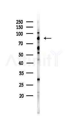MGH1/2 Antibody - Western blot analysis of lysates from COLO205 cells(UV,30min treatment), using MGH1/2 Antibody at 1/1000 dilution.