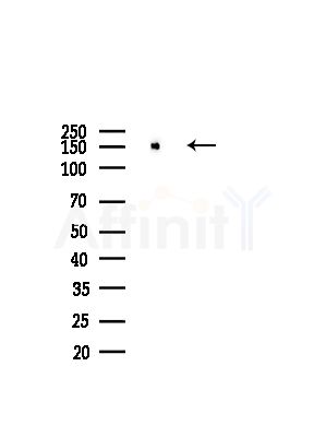 DIAPH1 Antibody - Western blot analysis of lysates from Hela cells(starvation,24h treatment), using DIAPH1 Antibody at 1/1000 dilution.