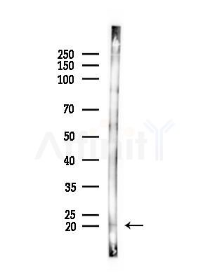 NDUFB11 Antibody - Western blot analysis of lysates from Rat brain, using NDUFB11 Antibody at 1/1000 dilution.