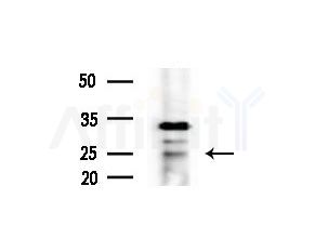 NDUFS7 Antibody - Western blot analysis of extracts from HepG2 cells(heat-shock treatment), using NDUFS7 Antibody at 1/1000 dilution.