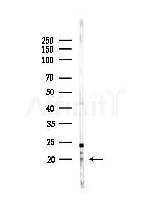 NDUFS7 Antibody - Western blot analysis of lysates from HepG2 cells(heat-shock,45min treatment), using NDUFS7 Antibody at 1/1000 dilution.