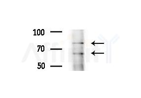 NUFIP1 Antibody - Western blot analysis of extracts from COLO205 cells(heat-shock treatment), using NUFIP1 Antibody at 1/1000 dilution.
