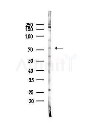 NUFIP1 Antibody - Western blot analysis of lysates from COLO205 cells(heat-shock,45min treatment), using NUFIP1 Antibody at 1/1000 dilution.
