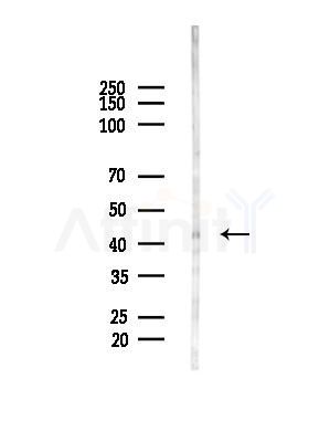 PMPCB Antibody - Western blot analysis of lysates from HUVEC cells(LPC4h treatment), using PMPCB Antibody at 1/1000 dilution.