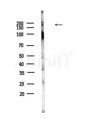 PRPF8 Antibody - Western blot analysis of lysates from HepG2 cells(heat-shock,45min treatment), using PRPF8 Antibody at 1/1000 dilution.