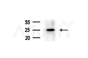 RAP1B Antibody - Western blot analysis of extracts from COLO205 cells(heat-shock treatment), using RAP1B Antibody at 1/1000 dilution.