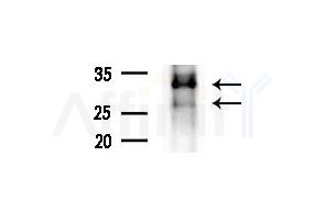 RND3 Antibody - Western blot analysis of extracts from COLO205 cells(heat-shock treatment), using RND3 Antibody at 1/1000 dilution.