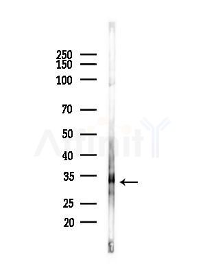 RND3 Antibody - Western blot analysis of lysates from COLO205 cells(heat-shock,45min treatment), using RND3 Antibody at 1/1000 dilution.