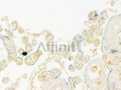 RND3 Antibody - DF12311 at 1/100 staining human normal placenta tissue by IHC-P.