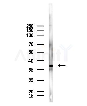 RQCD1 Antibody - Western blot analysis of lysates from HepG2 cells(starvation,24h treatment), using RQCD1 Antibody at 1/1000 dilution.
