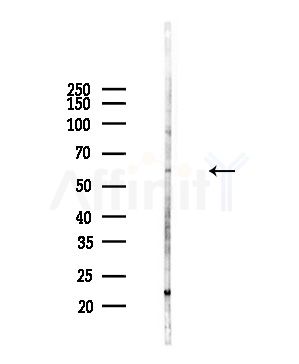 Secretogranin III Antibody - Western blot analysis of lysates from Hela cells(heat-shock,45min treatment), using Secretogranin III Antibody at 1/1000 dilution.