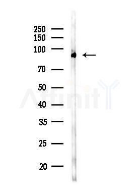 SFPQ Antibody - Western blot analysis of lysates from COLO205 cells(UV,30min treatment), using SFPQ Antibody at 1/1000 dilution.