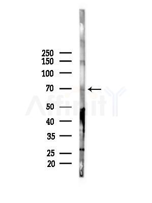 SLC38A3 Antibody - Western blot analysis of lysates from Mouse liver, using SLC38A3 Antibody at 1/1000 dilution.