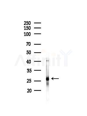SNRPB2 Antibody - Western blot analysis of lysates from HepG2 cells(heat-shock,45min treatment), using SNRPB2 Antibody at 1/1000 dilution.