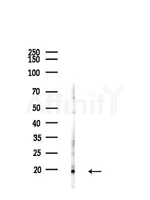 SRP14 Antibody - Western blot analysis of lysates from COLO205 cells(UV,30min treatment), using SRP14 Antibody at 1/1000 dilution.