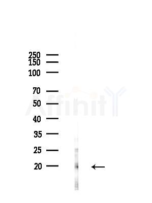 SRP14 Antibody - Western blot analysis of lysates from LoVo cells(heat-shock,45min treatment), using SRP14 Antibody at 1/1000 dilution.