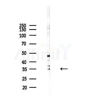 Stanniocalcin 2 Antibody - Western blot analysis of lysates from Hela cells(heat-shock,45min treatment), using Stanniocalcin 2 Antibody at 1/1000 dilution.